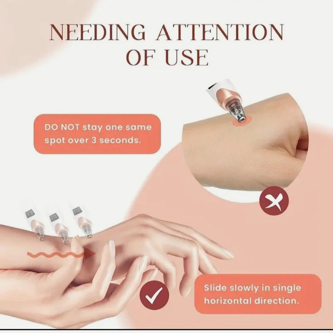 Electric Blackhead Remover Pore Vacuum Acne Cleaner Facial Skin Care USB LED