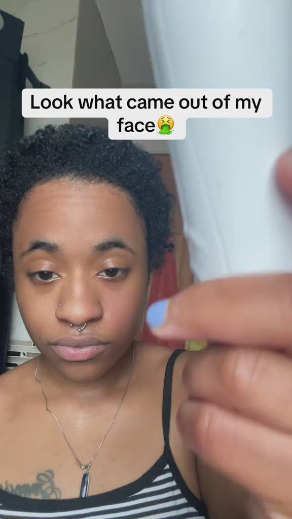 Electric Blackhead Remover Pore Vacuum Acne Cleaner Facial Skin Care USB LED